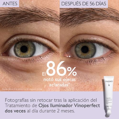 CAUDALIE VINOPERFECT OJOS LUMINOSIDAD RESULTADOS 2 CAUDALIE VINOPERFECT OJOS LUMINOSIDAD RESULTADOS 2